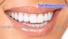 https://supplementhub.org/teeth-whitening-system/