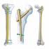 A Reliable Orthopedic Implants Company